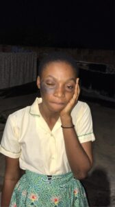 Assistant Headmaster allegedly slapped Student, School and Police Fail to Act | 1