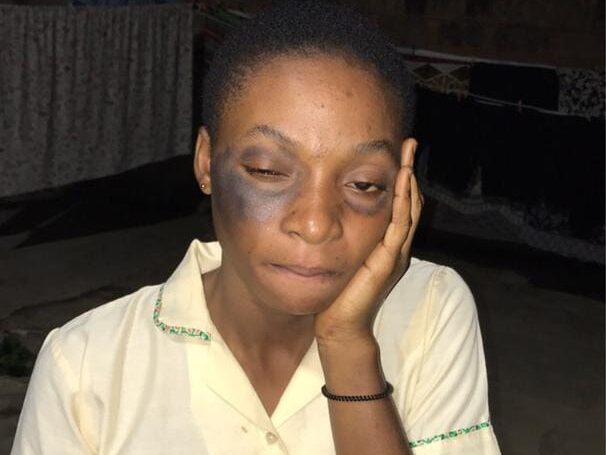 Assistant Headmaster allegedly slapped Student, School and Police Fail to Act